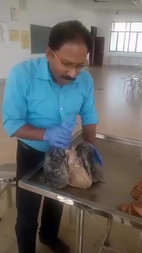 Inflating human lungs by blowing it 🫁 #medicine #medicalstudent #trendingoftiktok #following #like