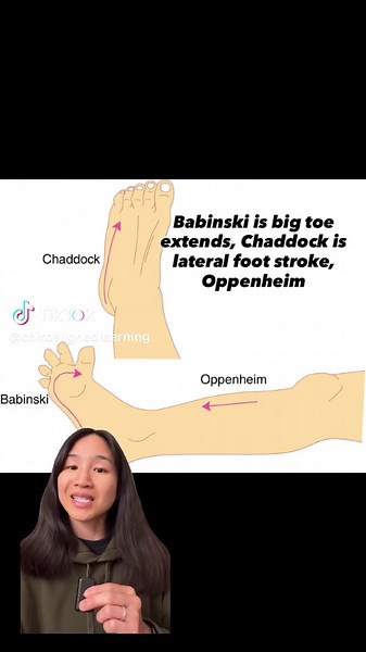Understanding Key Reflexes in Neuroanatomy
