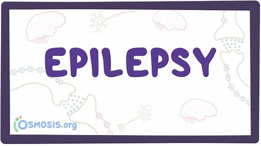 Epilepsy: Video, Causes, & Meaning | Osmosis