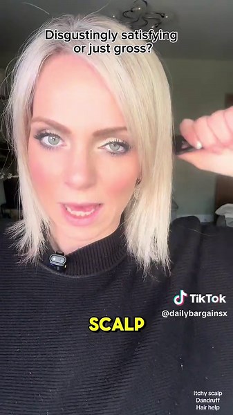 Effective Anti-Dandruff Comb for Healthy Scalp