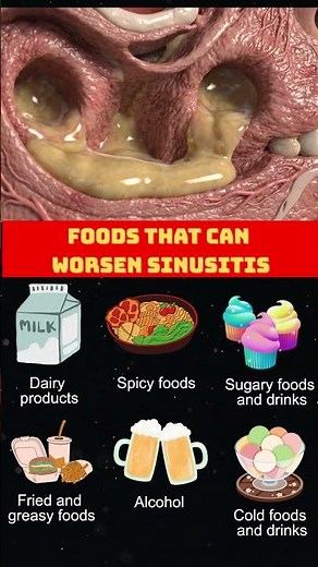Sinusitis | Sinus Problems | Foods You Should Be Careful With #shortsfeed