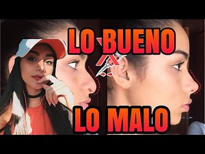 Lo BUENO y lo MALO Respingadores nasales || Rinoplastia Casera en minutos