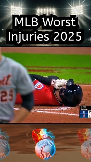 MLB Worst Injuries 2025 #baseballlife #mlb #baseball #beisbol | Beisbol Viral