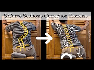 Scoliosis : Double Curve Scoliosis Correction Exercise in Sitting (S Curved Spine)