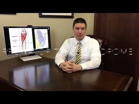 Pronator Teres Syndrome