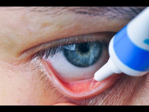 How do you use erythromycin ointment for a stye