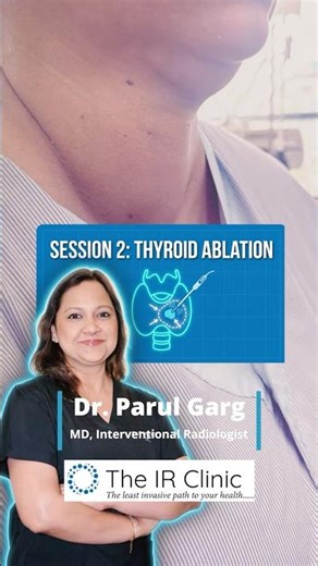 11 cm Thyroid Nodule Ablation (Session 2) 🦋 | Large Nodule, Multi-Stage Treatment