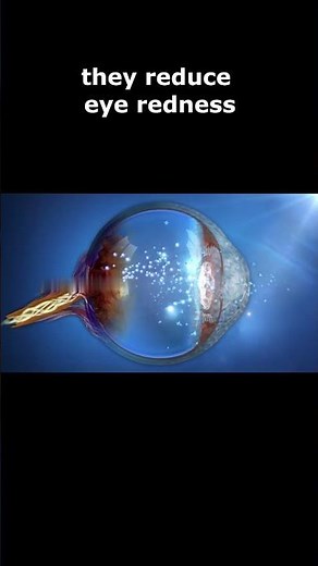 Getting Rid of Red Eyes - Do your research on eye drops