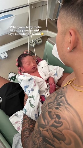 My little preemie 🥺👼🏻🫶 #34weekspregnant #momtok #pregnant #pregnancytiktok #preemiemom #pregnantcheck #maybaby #babyannouncement