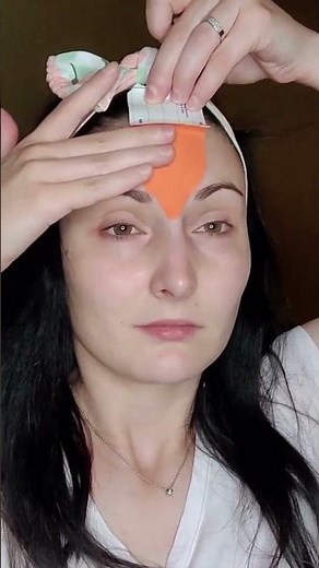 How to remove forehead wrinkles with tape? Forehead taping