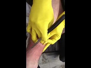 HUGE leg cyst explodes