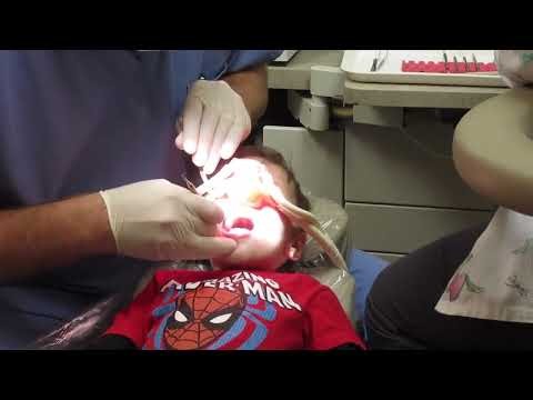FUNNY LAUGHING GAS! First Trip to the Dentist Kash s Korner 1080p