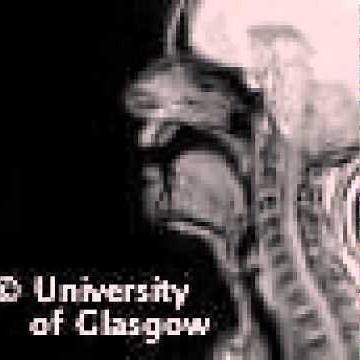 MRI voiced alveolar tap