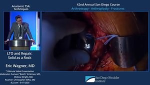 Subscapularis Osteotomy: Relive Surgery