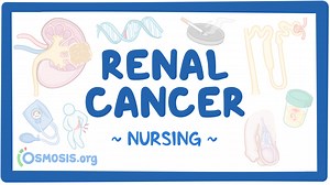 Renal cancer: Nursing: Video & Causes | Osmosis