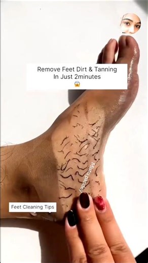 Remove Dark Feet Dirt & Tanning at Home|Easy Foot Care #shortsfeed#ytshorts #feetwhiteningtips#short