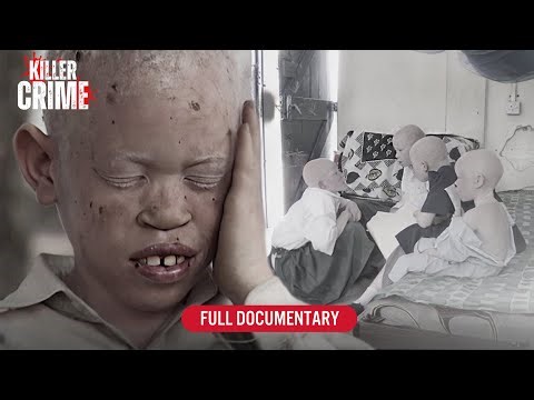 The Untold Story of Albino Community – Award-Winning Doc | Curse of the Nobody People | Full Doc