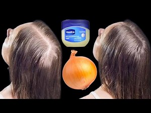 How to use Vaseline for double hair growth, your hair will grow 3 times faster