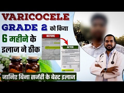 bina surgery ke varicocele grade 2 hua thik | cure varicocele grade 2 without surgery