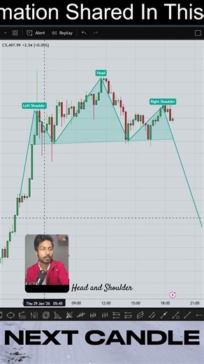 Head and Shoulder Pattern – Trend Reversal Signal 🔥#trading