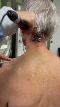 Microcurrent Demo Neck Pain W/ Forward Head Syndrome