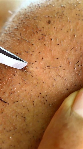 The Sting of Every Strand Beard Plucking Unveiled16