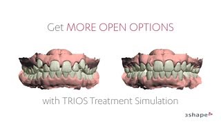 7K views · 194 reactions | 3SHAPE TRIOS TREATMENT SIMULATOR - A...