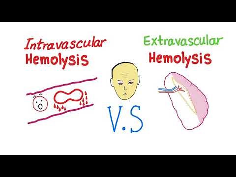 Intravascular Vs Extravascular Hemolytic Anemia; What's The ACTUAL Difference?