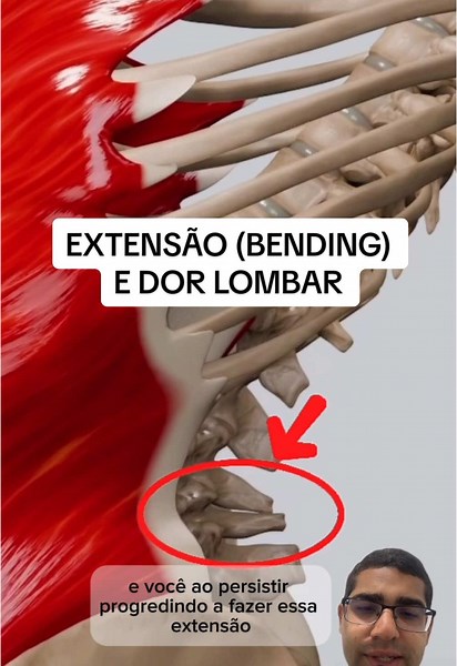 Entenda a Síndrome de Baastrup e seu tratamento