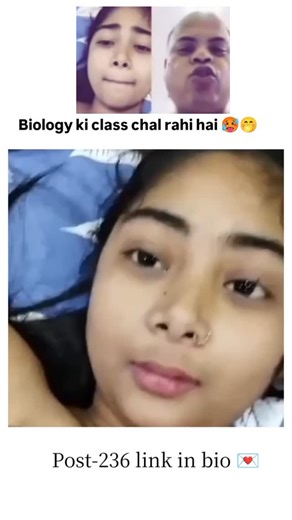 Reels Fun Zone on Instagram: "Full Video Link In Bio & Follow @fatima.qu02 😅 pnglinks Here's some basic information about the human ears: _Structure:_ 1. Outer ear (pinna or auricle): Collects sound waves 2. Ear canal (auditory canal): Sound waves travel through 3. Eardrum (tympanic membrane): Vibrates from sound waves 4. Middle ear: Contains bones (ossicles) that transmit vibrations 5. Inner ear: Converts vibrations into electrical signals 6. Cochlea: Spiral-shaped structure for sound p