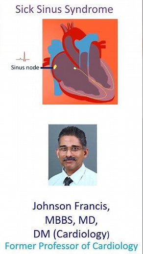 What is Sick Sinus Syndrome?