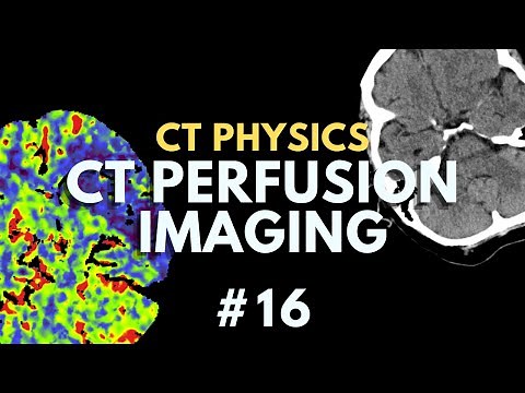 CT Perfusion Imaging Explained | TTP, CBV, CBF, MTT, Tmax | CT Radiology Physics Course #16