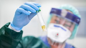 Kampf gegen Corona: Wie fit ist unser Gesundheitssystem? Zu wenig Schutzkleidung, zu wenig Personal, unklare Zuständigkeiten: Das Corona-Virus macht die Schwachstellen im deutschen Gesundheitssystem sichtbar. Ein Gesundheitssystem, das in den letzten Jahren auf Profitorientierung getrimmt wurde – und wichtige Fragen der Daseinsvorsorge in den Hintergrund rückte. Genau das könnte jetzt zum Problem werden, warnen Experten. | Monitor