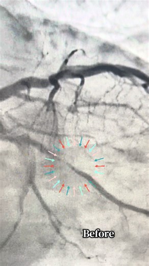 Navigating the Cath Lab: Insights for Healthcare Professionals