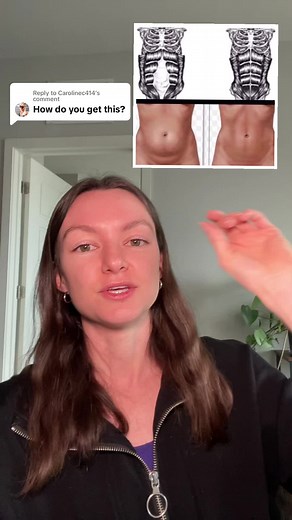 Understanding Diastasis Recti: Causes and Prevention Tips