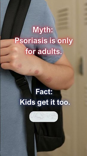Psoriasis in Children and Teens — What Parents Need to Know