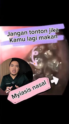 Myiasis Nasal: Ketika Larva Bersarang di Rongga Hidung