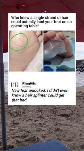 Surgery for a Hair Splinter?!