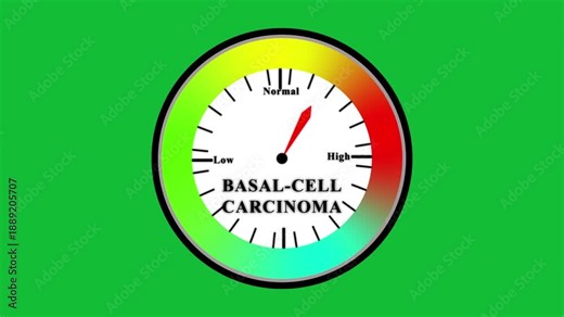 BASAL-CELL CARCINOMA text or word displayed with a barometer tachometer-style gauge showing from low to normal to high gauge isolated on green and black background, maximum reading speedometer,