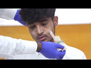 REMOVING SPLINT AFTER 7 DAYS AFTER SURGERY