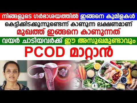 What is PCOD and how to completely cure it?