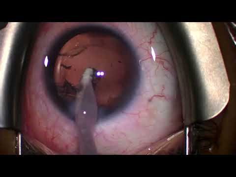 2025 12 08 102614 Panoptix pro