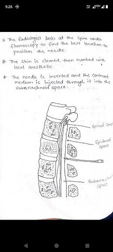 Myelogram Notes for Paramedical