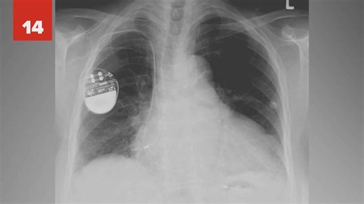 Accidental inventions that changed the world forever