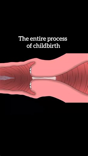 Healthy organ on Instagram: "Childbirth, or labor, is the process by which a baby is born. It begins with contractions of the uterus, which help dilate the cervix. The process has three main stages: early and active labor (cervix opens), delivery of the baby (baby moves through the birth canal), and delivery of the placenta. Pain and discomfort are common, and medical support may include monitoring, pain relief, or surgical interventions like cesarean section if necessary. After birth, both moth