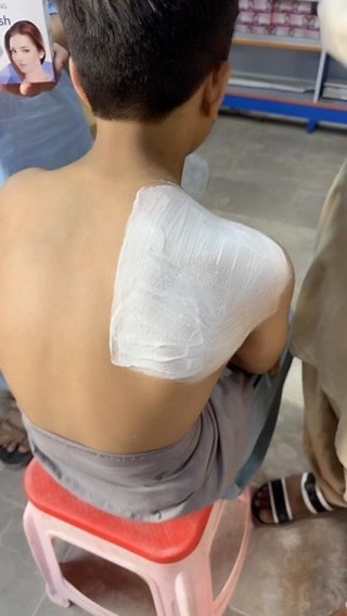 Ameen Beauty Tips on Instagram: "Glow & Clean Ultra Whitening Skin Polish Amazing Result #reels"