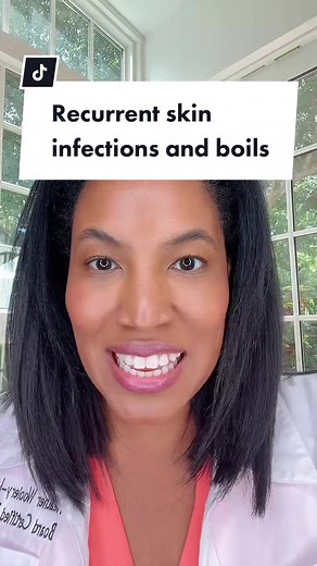 Effective Ways to Treat and Prevent Recurring Boils | Expert Tips