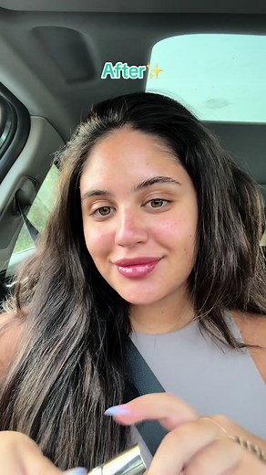 Transform Your Skin with Hydrafacial Treatment: Before and After Results