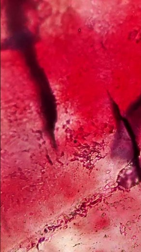 SCAB UNDER THE MICROSCOPE🔬