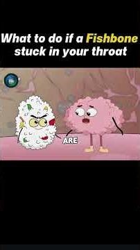 Ever wondered what happens when a fishbone gets stuck in your throat?